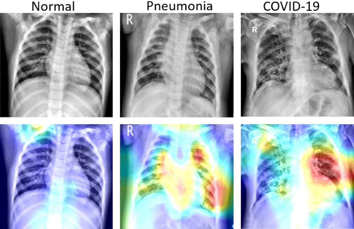 COVID-19 Detection